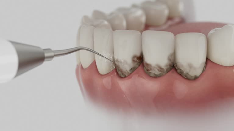Reliable Emergency Dentist contractor in Lake Forest, CA by Smile Center Dentistry